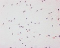 Human spermatozoa, x40, Papanicolaou stain