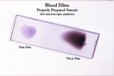 Blood Smear Slide