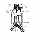 Fig. 9 Horseshoe kidney