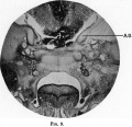 Fig. 9. Coronal section of a 19 mm Embryo