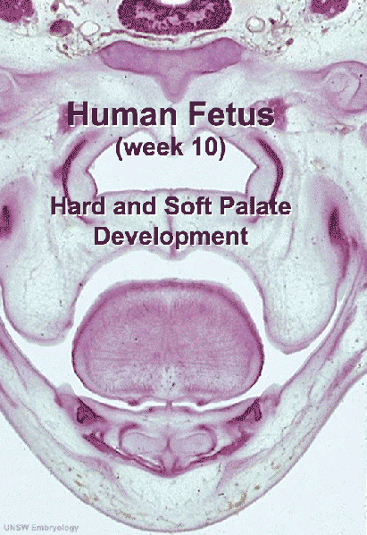 File:Fetal week 10 palate 01.gif