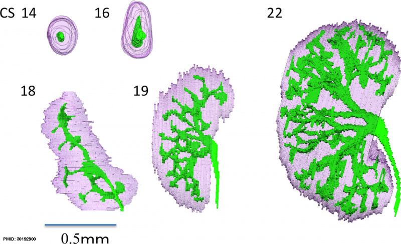 File:Human embryonic renal branching 1.jpg