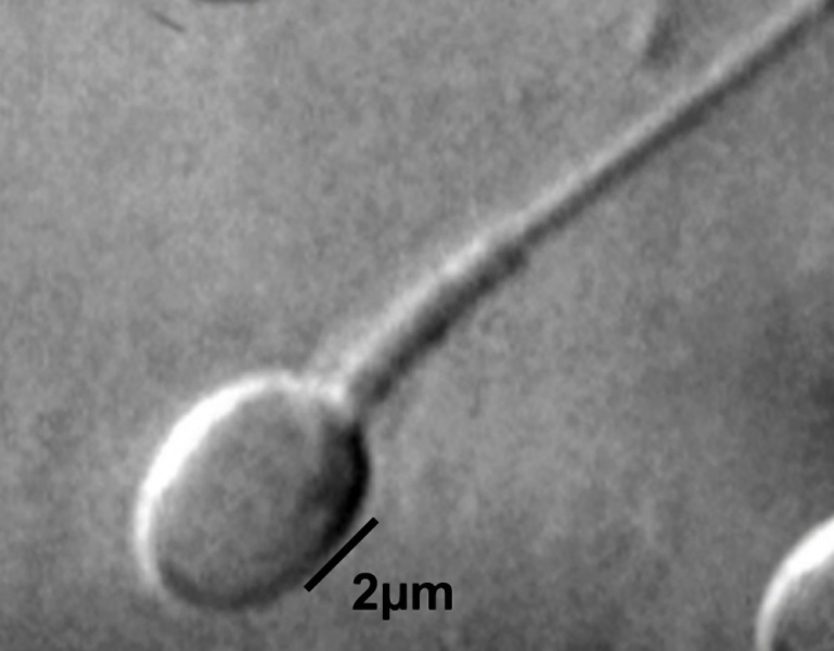 File:Single human spermatozoa.jpg
