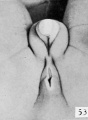 Fig. 53. No. 1S31, 93.5 mm., female. X 4.