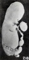 Fig. 218. A fetus and cord showing marked maceration changes. No. 797. X1.35.