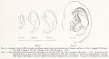 Embryo ear cartilage 21 - 50 mmm CRL