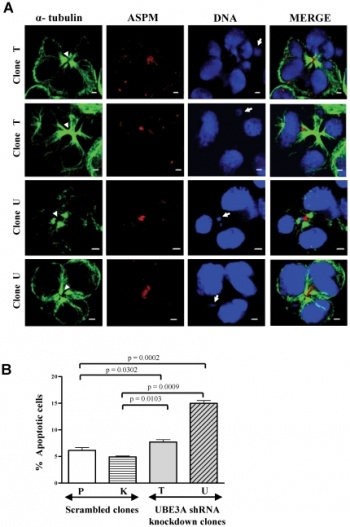 Abnormal cytokinesis and apoptosis in UBE3A knockdown cells.jpg