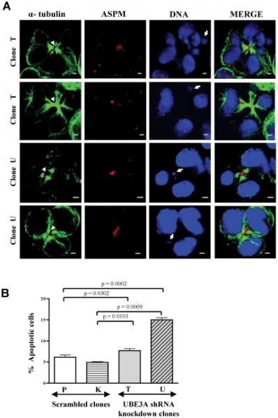 File:Abnormal cytokinesis and apoptosis in UBE3A knockdown cells.jpg