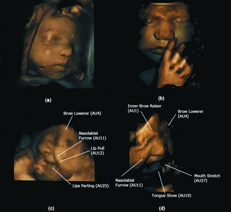 Ultrasound Embryology