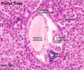 Liver histology 005.jpg