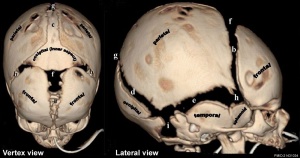 Skull CT fontanel and sutures
