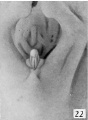 Fig. 22. Carnegie Embryo 1358h Male