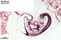 Human embryo (CRL 4.2 mm) Blechschmidt Collection