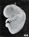 Figs. 42-50. Various forms of cyemata classed as fetus compressus: Nos. 1301 (X8.5).