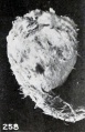 Fig. 258. External appearance of abortus, same case. X0.75.