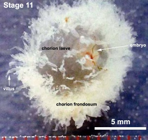 Embryo-membranes stage 11.jpg