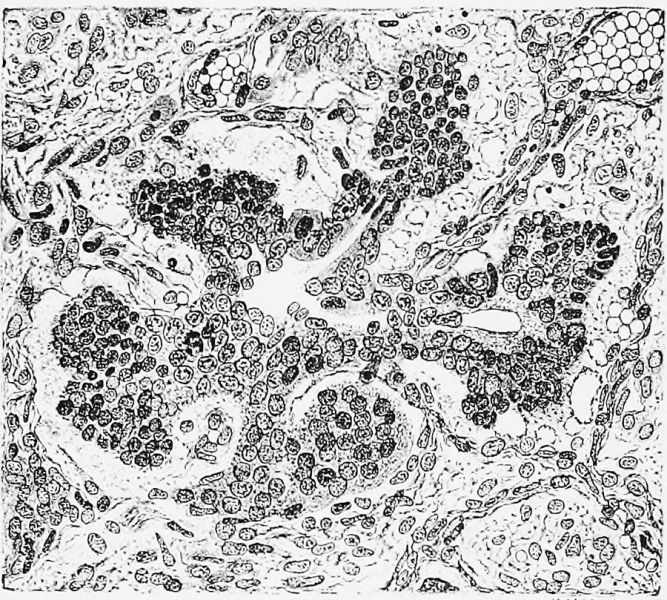 File:Pearce1903 fig01.jpg