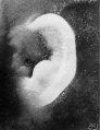 Fig. 48. Embryo No. 2003, 103.5 mm.