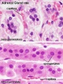 Adrenal - Zona Glomerulosa and Fasciculata