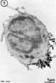 B lymphocyte TEM
