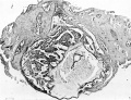 Fig. 1. The ovum in situ.