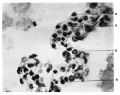 Fig. 18. Flattened and cubical cells Full term embryo