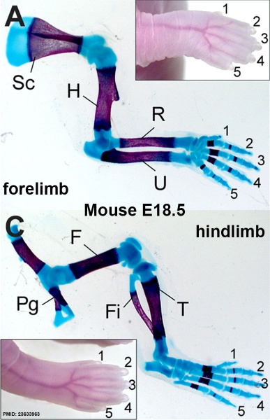 File:Mouse limb cartilage and bone E18.5.jpg