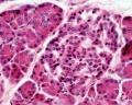 Pancreas histology 103.jpg