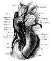 Fig. 1 Horseshoe kidney