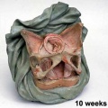 Week 10 Fetus Model