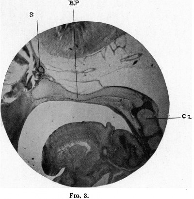 Fig. 3. photograph of a sagittal section of the head of the 21 mm. embryo