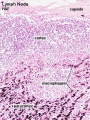 Lymph Node - macrophages