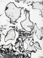 Fig. 136. Hydatiform villi in section. No. 825. X45.
