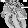 fig 29a Mouse E18.5 heart atrioventricular septal defect