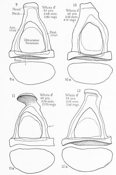 File:BeatonAnson1940 fig09-12.jpg