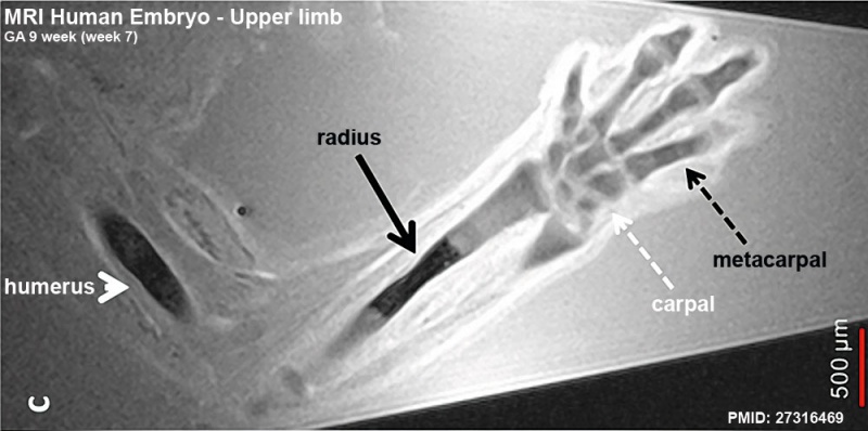 File:MRI Human Embryo - upper limb 02.jpg