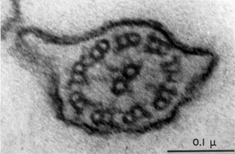 File:Spermatozoa tail EM01.jpg
