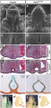 External genitalia development Z5015544 Reference and student template included. Wrong copyright statement APS not for Development. Development does allow "Use for bona fide teaching is allowed on the condition that it is non-commercial." http://dev.biologists.org/content/rights-permissions so I will allow this ion the project page unless requested to remove.