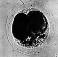 Fig. 5. Photograph of a living two-cell stage ovum of the pony (P 5). Granular material is seen in the lower part of the perivitelline space. x 480.