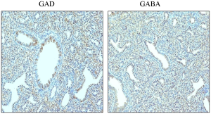 Immunolocalisation of GAD and GABA receptors in fetal lung tissue sections in mice.png