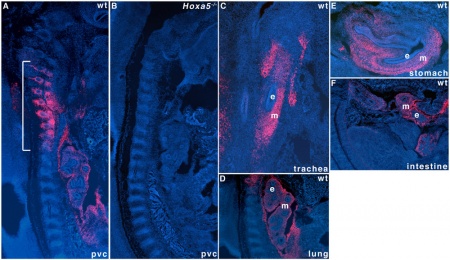 Developmental Signals - Homeobox - Embryology