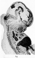 Fig. 14. Mesial section through the head of a human embryo of the seventh week. It shows the great expansion of the cavity of the brain-part of the neural tube as well as the strongly-marked brain flexures.