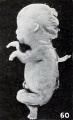 Figs. 52-63. Illustrating the absence of fundamental differences between the group of fetus compressus and grade 3 of the normal specimens. No. 1350 (fig. 60) normal. X0.58.