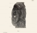 Plate 1. An Early Human Ovum Imbedded In The Decidua