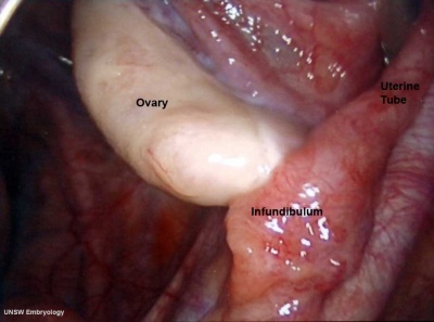 Human right ovary and tube 1.jpg