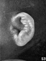 Fig. 53. Embryo No. 1811, 114 mm.