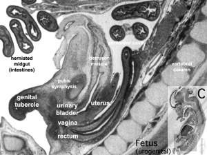 Fetal 10wk urogenital 3.jpg
