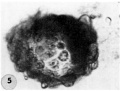 5 An intact 107-cell blastocyst