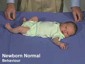 Neural Exam - Newborn normal behaviour - Embryology