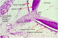 Retina development (stage 22)